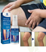 Varicose Vein Spray - OUHOE - Image 4
