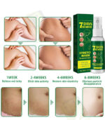 Stretch Mark Removal Spray - Jaysung - Image 5