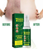 Stretch Mark Removal Spray - Jaysung