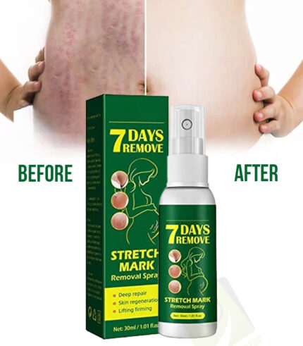 Stretch Mark Removal Spray - Jaysung