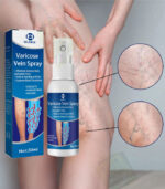 Varicose Vein Spray - OUHOE - Image 2